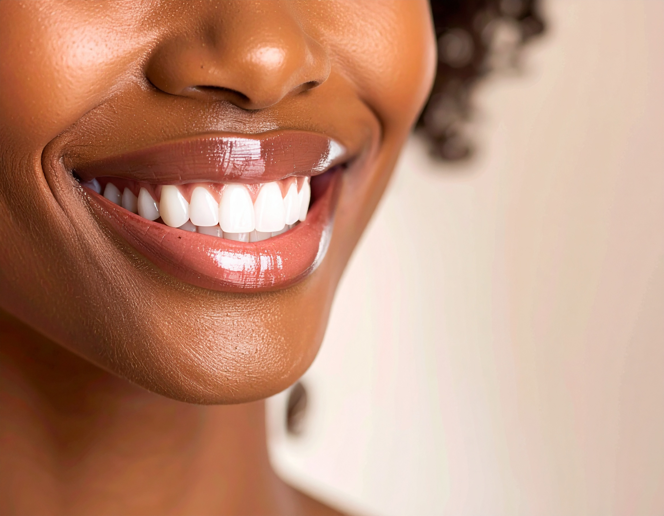 Bright and confident smile highlighting perfect white teeth