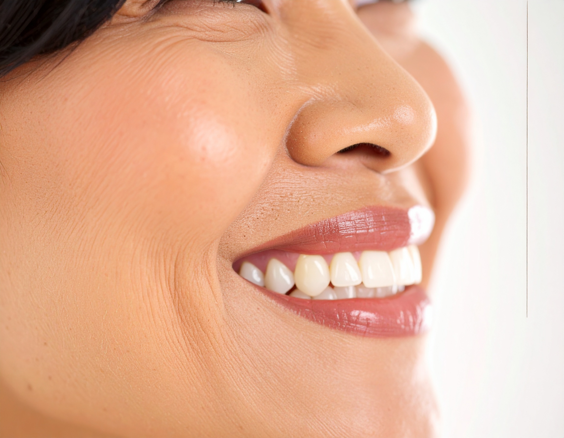 Close-up of a smiling woman's face highlighting dental and skin health